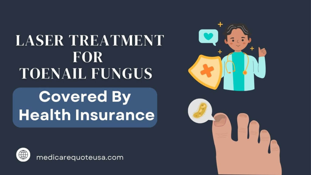 Does Health Insurance Cover Laser Treatment for Toenail Fungus in USA 2024