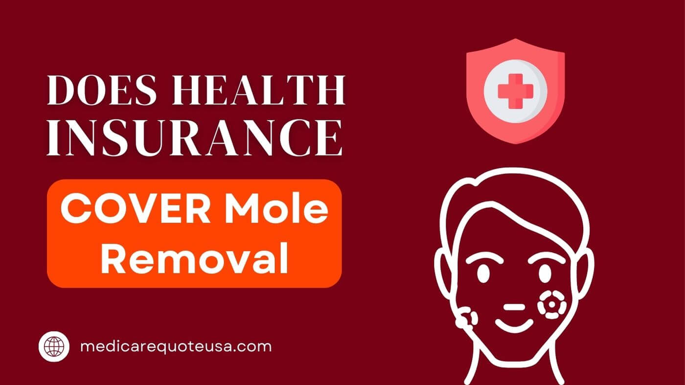 Does Health Insurance Cover Mole Removal in USA 2024