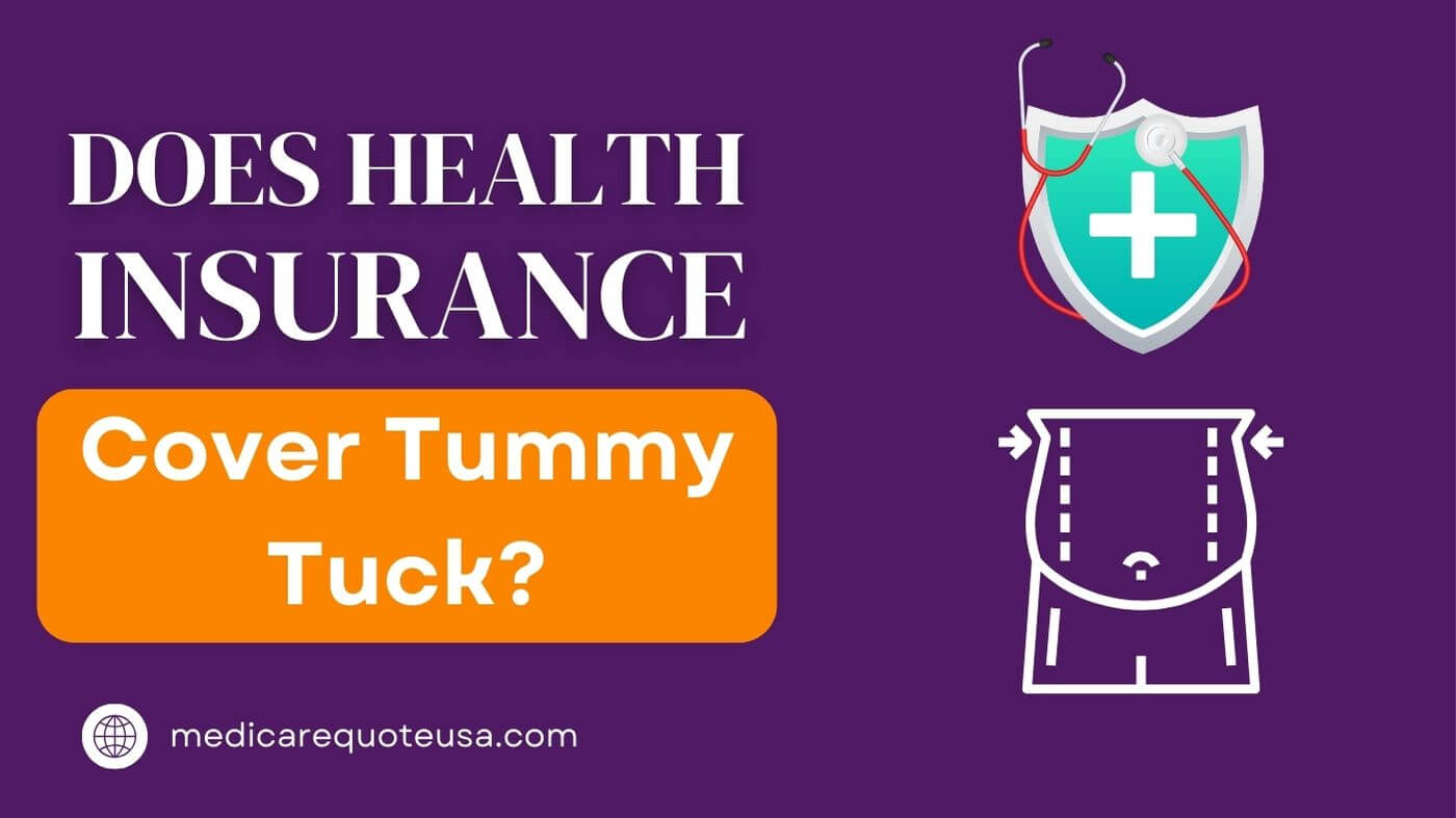 Does Health Insurance Cover Tummy Tuck in USA 2024