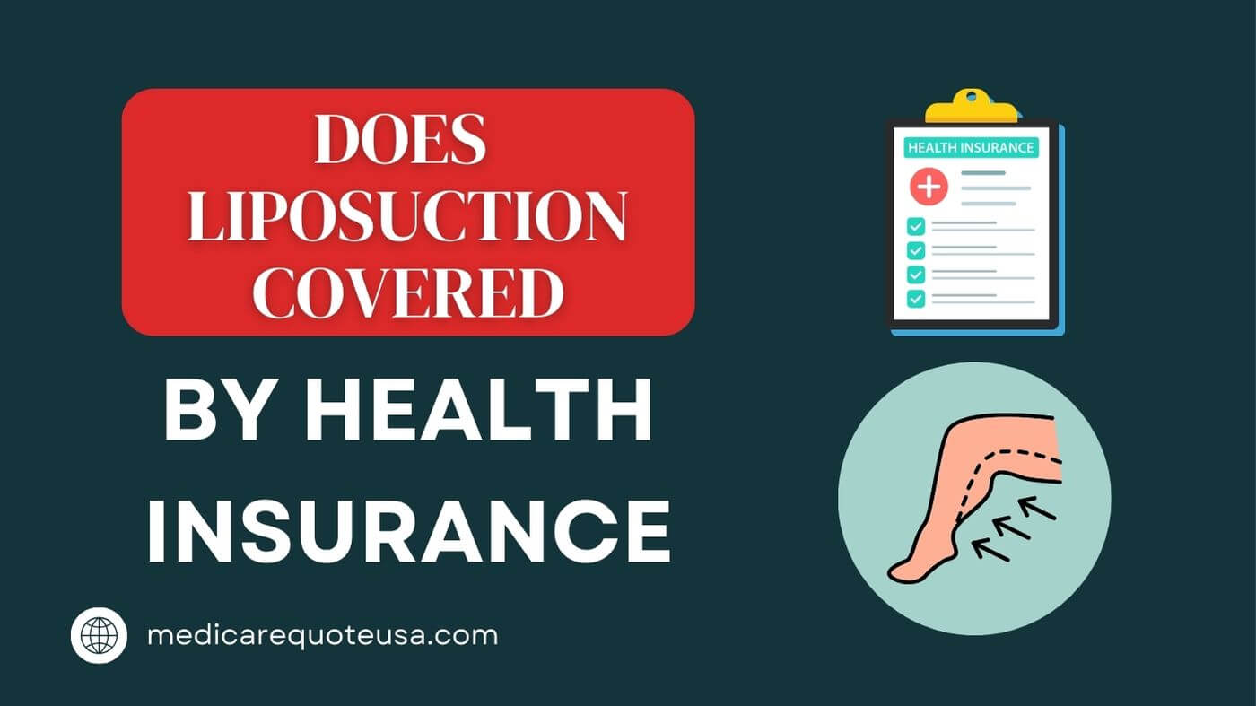 Does Liposuction Covered by Health Insurance in USA 2024