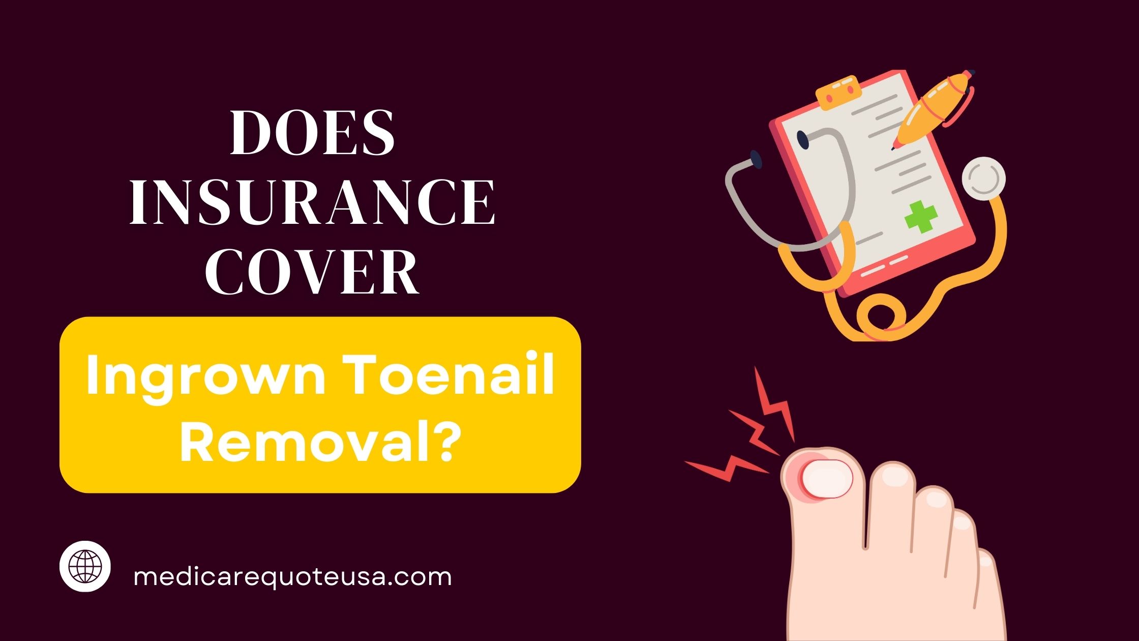 Does Insurance Cover Ingrown Toenail Removal In USA